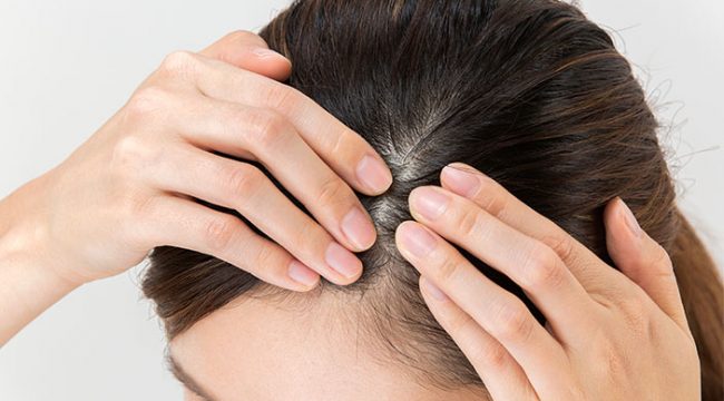Ilustrasi Perawatan Rambut (img: pexels.com by halodoc)