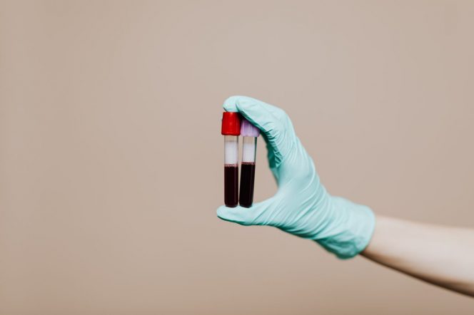
Gejala Anemia dan Cara Mengatasinya dengan Tepat